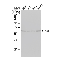 AKT antibody [N3C2], Internal (GTX121937)
